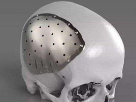 Medical titanium plate Medical titanium plate